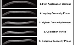 Exemplo da sequência de imagens usadas para o diagnónstico. Fonte: Revista Brasileira de Oftalmologia.